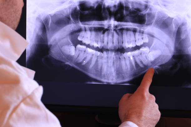 Best Weekend Emergency Dentist in Gonzales, TX