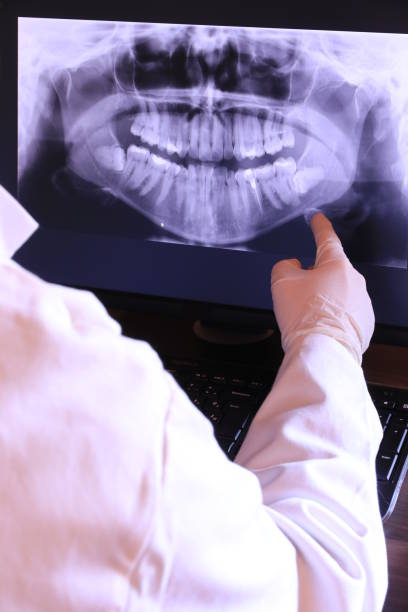 Best Emergency Dental Care for Abscessed Tooth in Gonzales, TX
